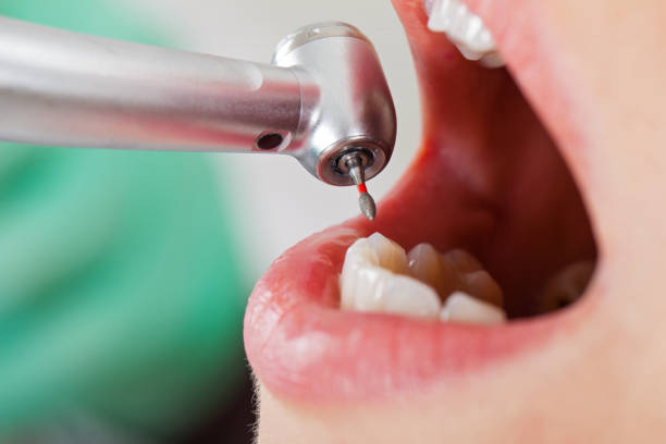 Best Emergency Root Canal Therapy in Shattuck, OK